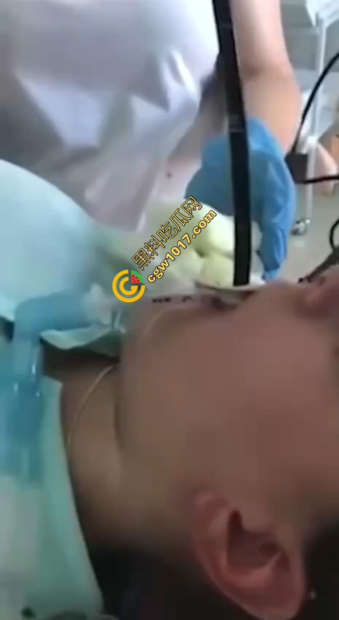 俄罗斯医院活拽1米毒蛇!女患者吞蛇卵孵化钻喉,医生手抖拽出瞬间到处乱窜!