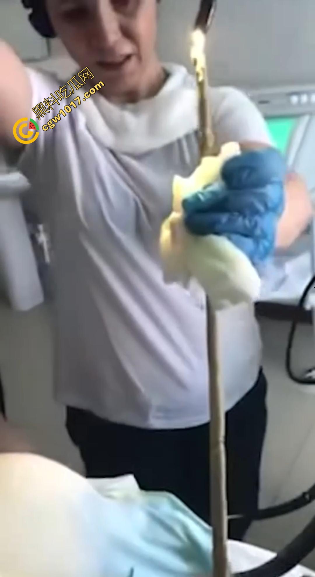 俄罗斯医院活拽1米毒蛇!女患者吞蛇卵孵化钻喉,医生手抖拽出瞬间到处乱窜!