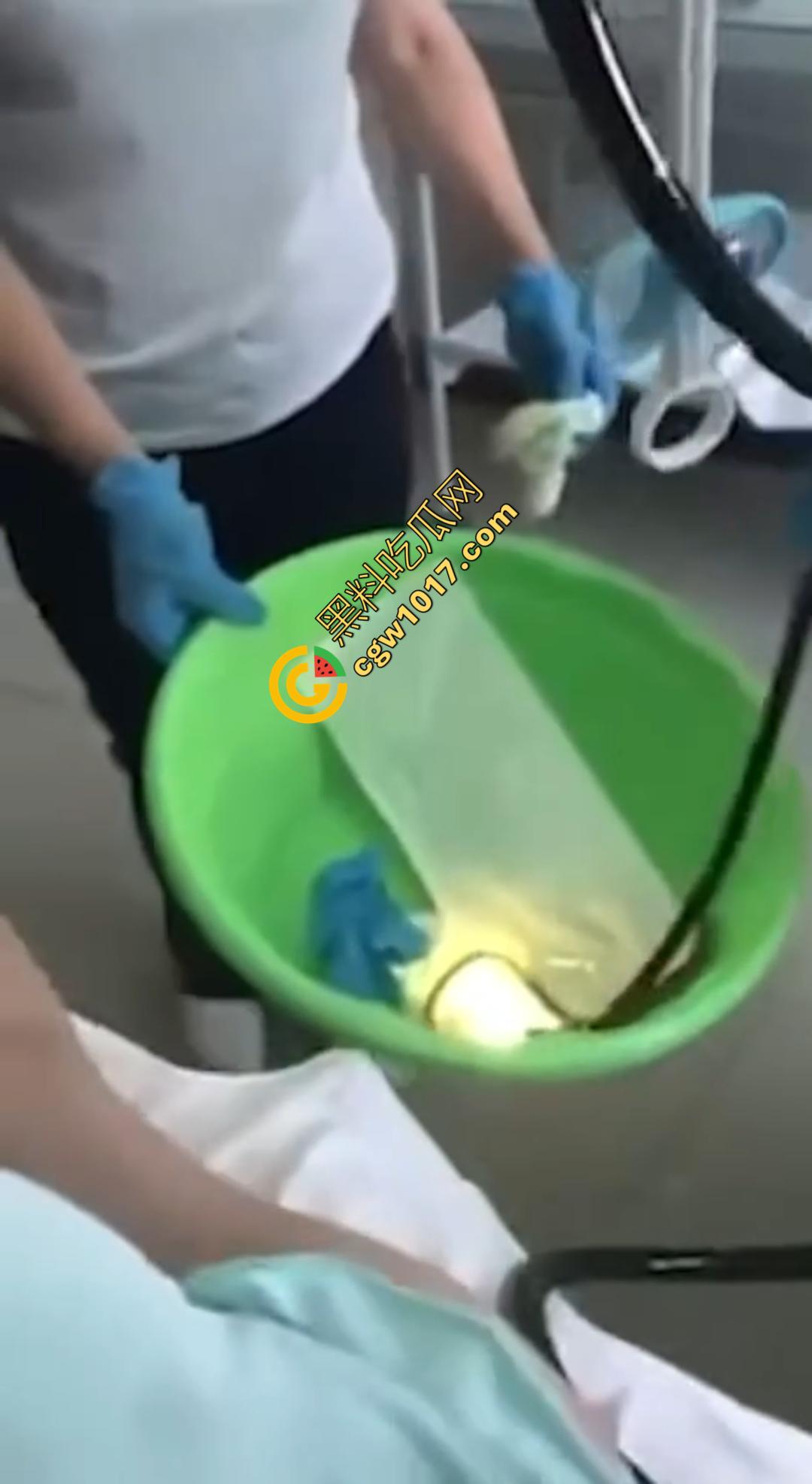 俄罗斯医院活拽1米毒蛇!女患者吞蛇卵孵化钻喉,医生手抖拽出瞬间到处乱窜!