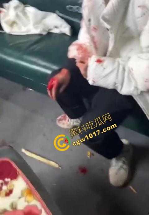 血腥慎点!社会混混残忍虐打小伙,马桶刷戳脸,铁管刺手,手背戳破血肉模糊,骨头暴露,惨不忍睹,令人心寒!