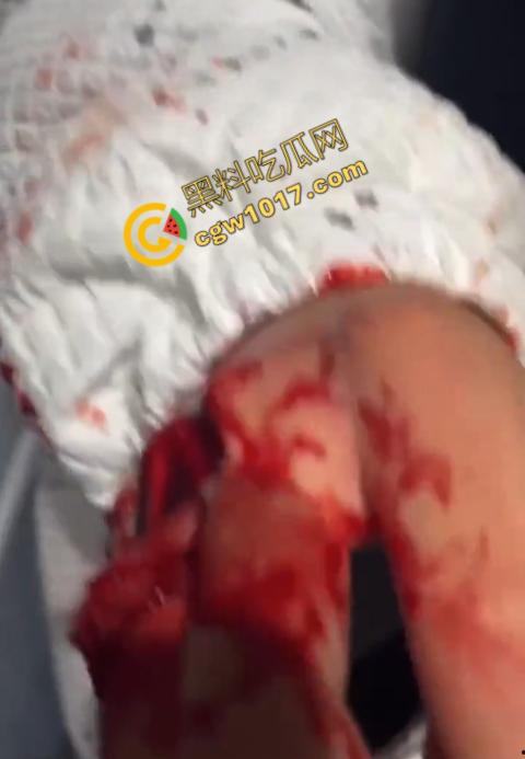 血腥慎点!社会混混残忍虐打小伙,马桶刷戳脸,铁管刺手,手背戳破血肉模糊,骨头暴露,惨不忍睹,令人心寒!