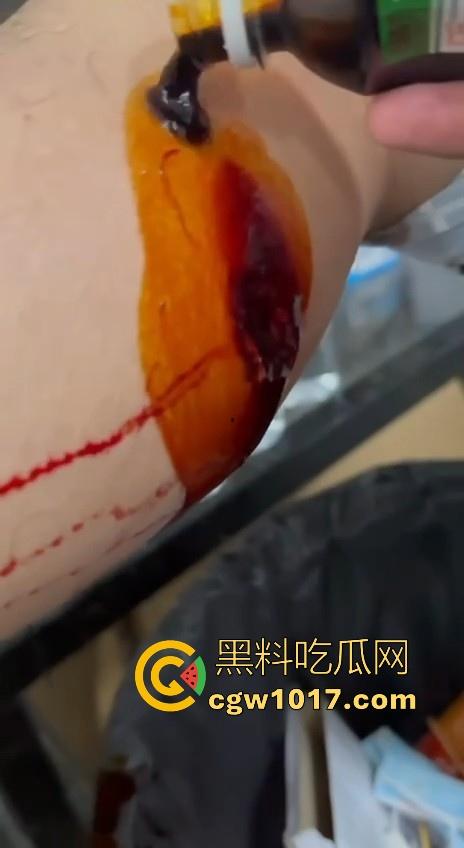 妙瓦底顺达园区缅甸KUN武装屠杀中国人!抢劫、轮奸、枪杀地盘之争,诈骗人员沦落为牺牲品,这时候你是中国人啦!