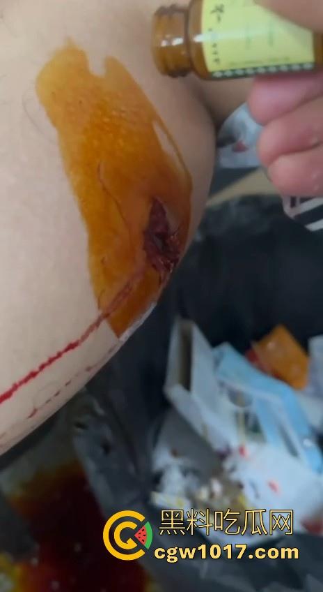 妙瓦底顺达园区缅甸KUN武装屠杀中国人！抢劫、轮奸、枪杀地盘之争，诈骗人员沦落为牺牲品，这时候你是中国人啦！