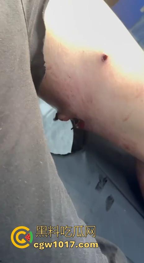 妙瓦底顺达园区缅甸KUN武装屠杀中国人！抢劫、轮奸、枪杀地盘之争，诈骗人员沦落为牺牲品，这时候你是中国人啦！