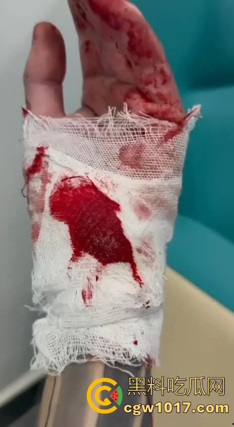 妙瓦底顺达园区缅甸KUN武装屠杀中国人！抢劫、轮奸、枪杀地盘之争，诈骗人员沦落为牺牲品，这时候你是中国人啦！