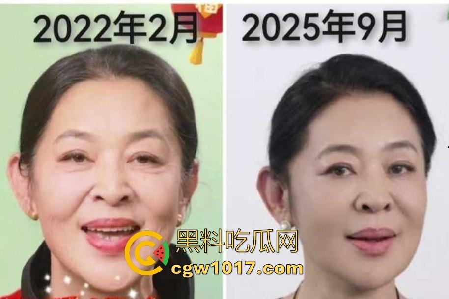 你见过心脏移植的明星吗?【李连杰】等众多大咖器官移植,换心换血黑科技年轻20岁,难道真有这种永生秘方?