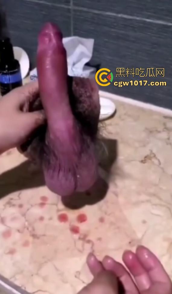 泰国自宫狂人嫌医院贵在家自割巨屌,落地后鸡巴还梆硬,后悔失去这武器,老爸见状怒吼“滚出家门”!