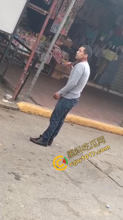 国外男子竟当街自残,刀割喉咙鲜血四溅,群众惊恐围观,男子倒地不省人事,惨烈一幕令人心悸胆战!