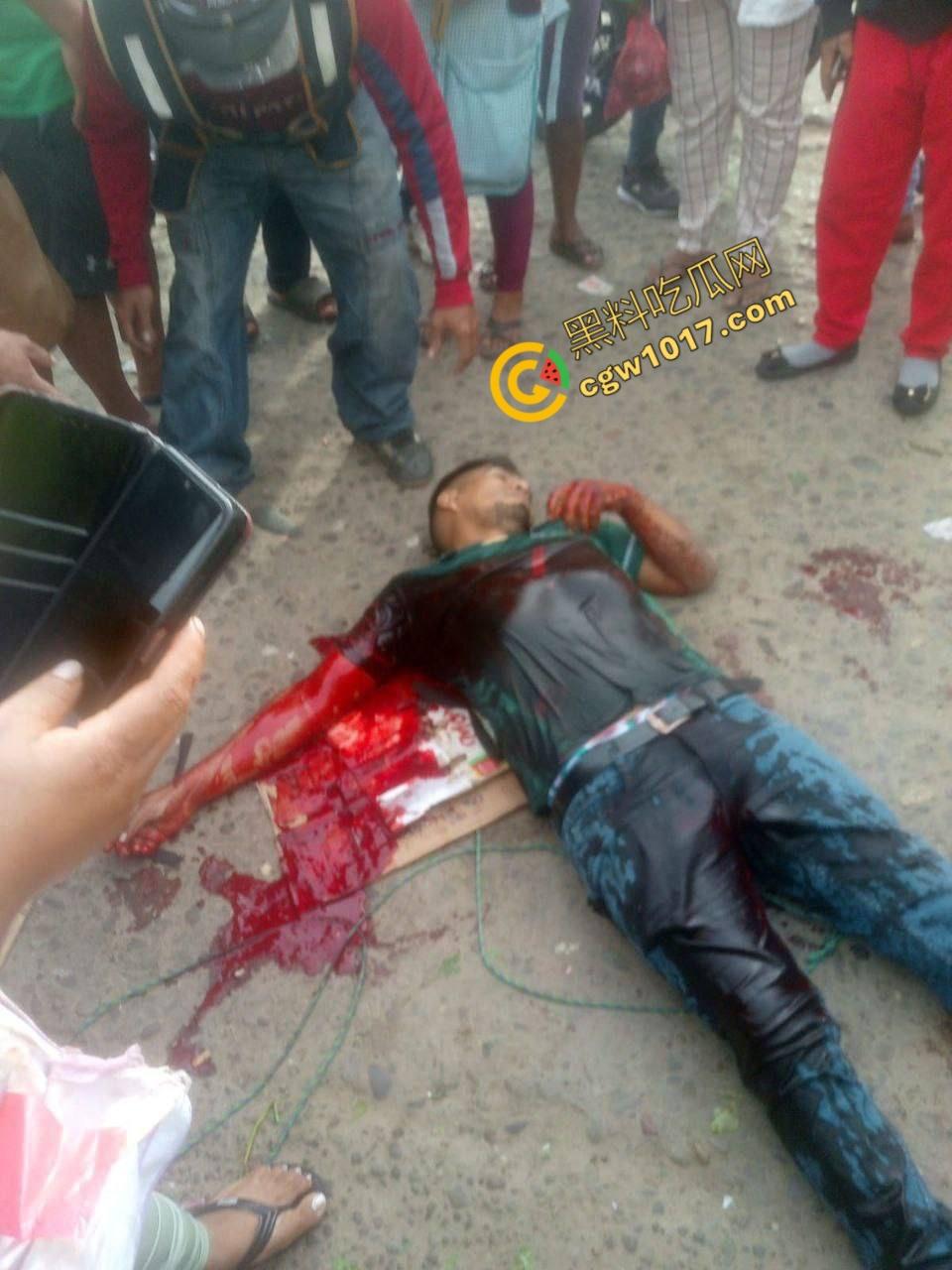 国外男子竟当街自残,刀割喉咙鲜血四溅,群众惊恐围观,男子倒地不省人事,惨烈一幕令人心悸胆战!