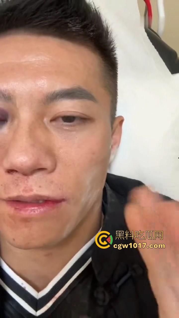 通背拳传人赵鸿刚参加UFC扇耳光大赛被对手KO!曾以为在耳光大赛上无敌的武功,没想到是这种下场,真是花拳秀腿!