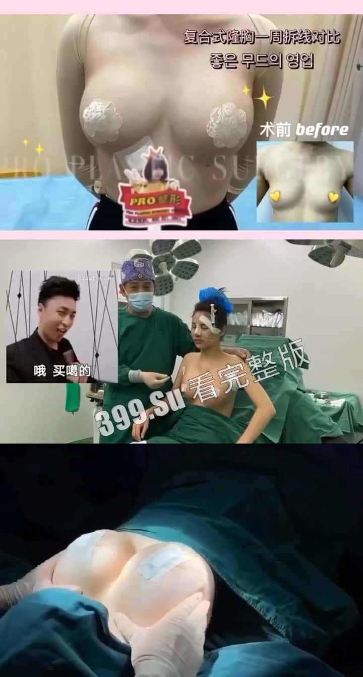 医美整形那些事儿 假的真不了 看的脸皮发麻 (三)