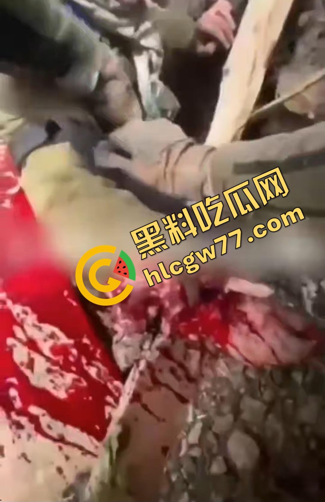 俄乌战场出现食人兵?士兵炸弹炸飞手臂骨髓喷溅,一旁队友饿了还吸食血液充饥!