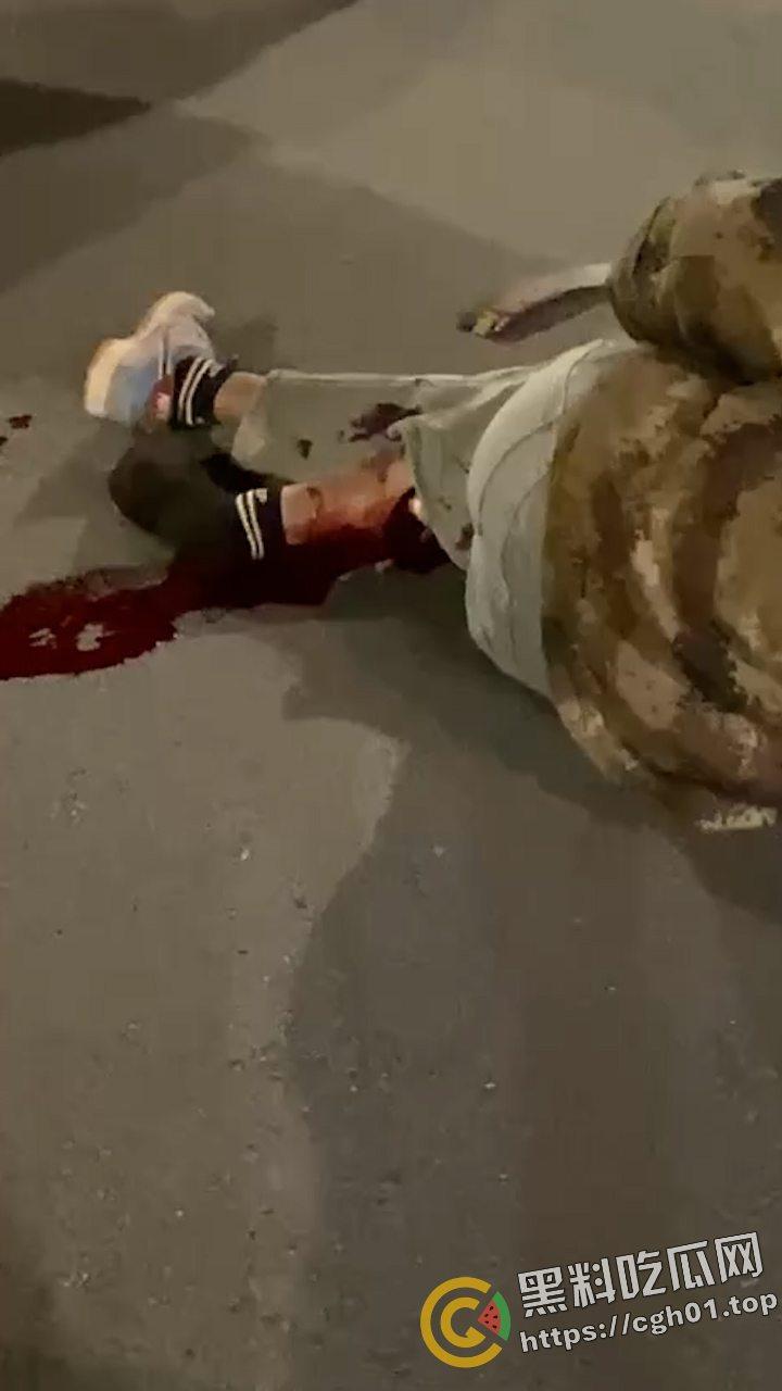 桂林野仔半夜飙车 把路人小腿撞断后没钱赔 有钱买鬼火 没钱擦屁股 现场血腥视频流出