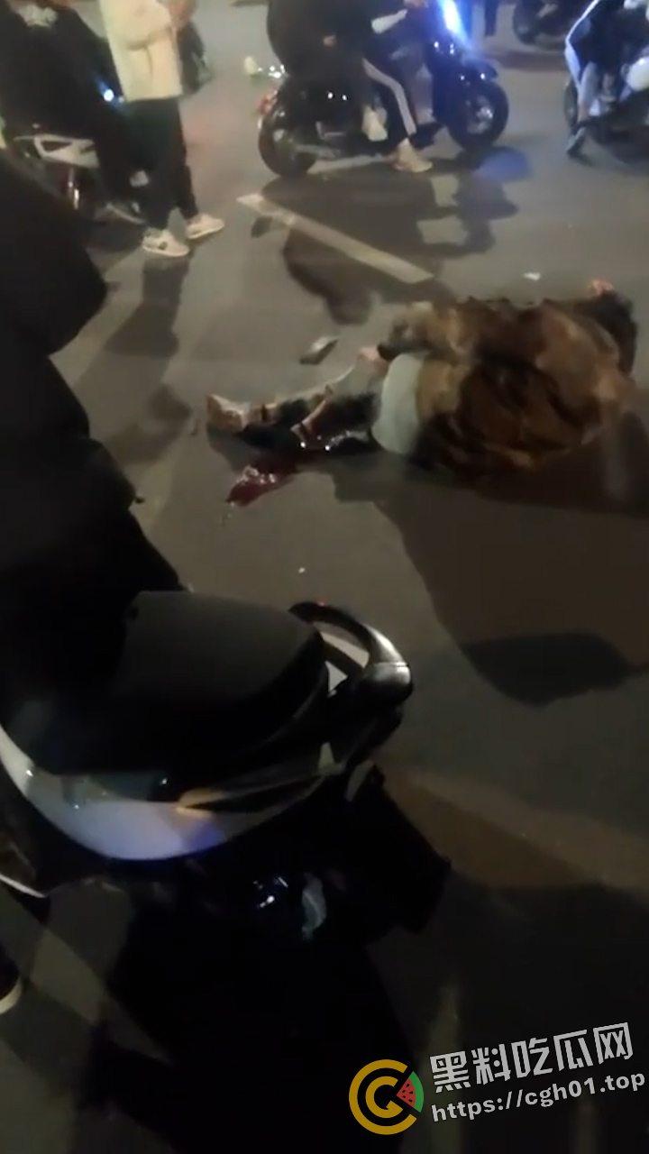 桂林野仔半夜飙车 把路人小腿撞断后没钱赔 有钱买鬼火 没钱擦屁股 现场血腥视频流出