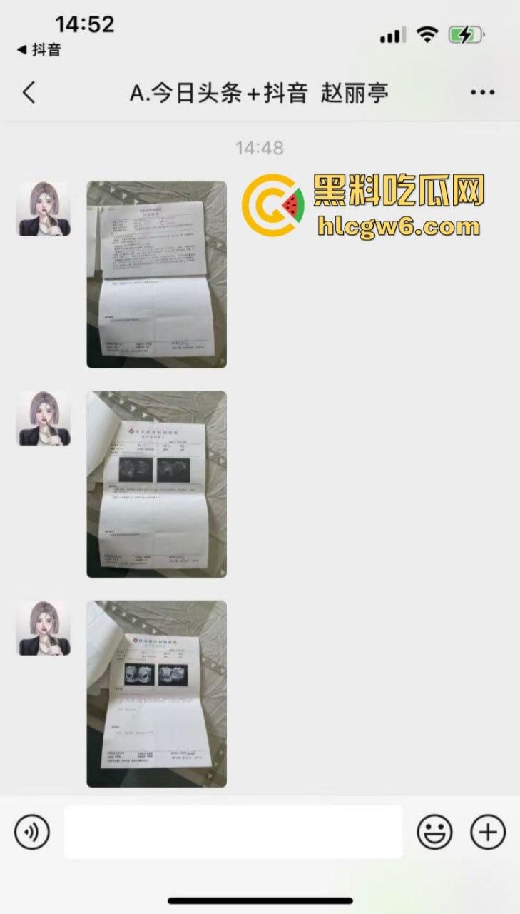 山西汾阳【赵丽婷】婚内出轨 结婚五年频繁出轨并打胎5次 被老公曝光并附带视频！